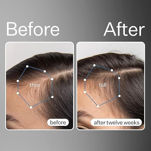 Act+Acre Cold Processed Stem Cell Scalp Serum - Promotes Thicker and Fuller-Looking Hair - Soothes and Hydrates the Scalp - Sulphate and Paraben Free - Aloe Vera for Improved Scalp Health - 1 fl oz. thumbnail 2