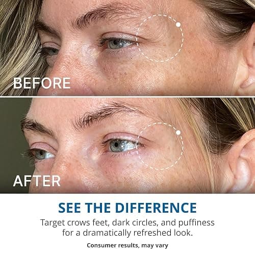goPure Advanced Repair Eye Cream - Under Eye Cream for Puffiness, Bags, and Dark Circles, Visibly Improve the Look of Fine Lines, Wrinkles, and Crows Feet - 0.57 fl oz thumbnail 4