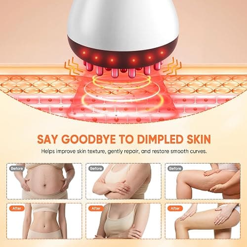 Rechargeable Lymphatic Drainage Massager & Cellulite Massage Tool with 3000mAh,Fascia Blaster for Reduce Stretch Marks for Legs, Arms & Belly,Body Sculpting Machine with Microcurrent for Office Travel thumbnail 5