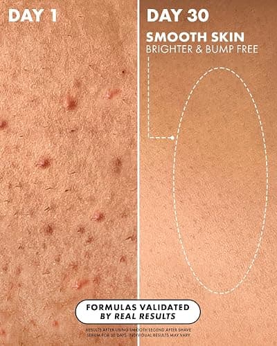 Truly Beauty Luxury After Shave Serum | Soothing & Hydrating Post Shave Treatment to Prevent Ingrown Hair For Smooth, Irritation-Free Skin thumbnail 3