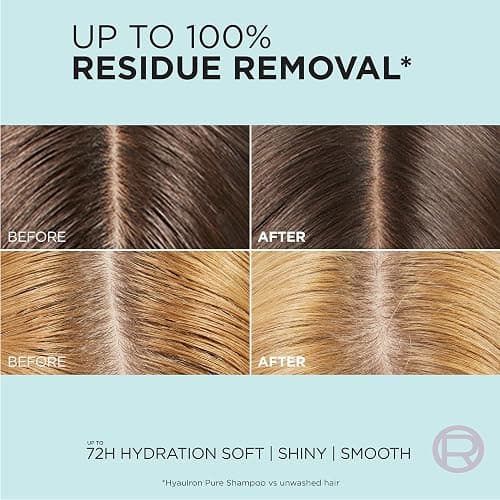 L'Oreal Paris Elvive Hyaluron + Pure Oil Erasing Scalp Serum with Salicylic Acid For Oily Hair, 3.45 Fl Oz thumbnail 3