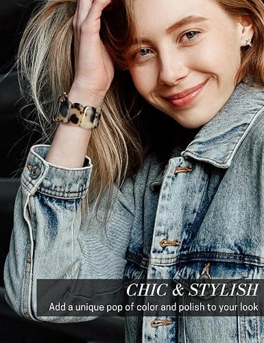 Heesch Tortoise Stretchy Watch Band Compatible with Apple Watch Serise Ultra/SE/8/7/6/5/4/3/2/1, Resin Cute Watch Strap Wristband for iWatch Bracelet for Women Men Girls, 38/40/41mm, 42/44/45/46/49mm, Oval Version thumbnail 4