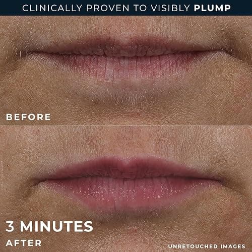 RoC Derm Correxion Lip Volumizer - Lip Plumper Peptide Treatment with Hyaluronic Acid & Vitamin E + Line Smoothing Eye Cream Packette thumbnail 5