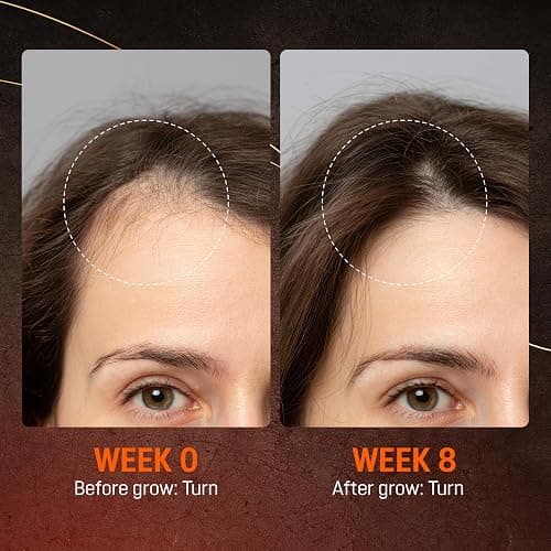 Abera Hair Growth Serum 1.69 fl oz for Hair Loss, Natural Hair Regrowth Treatment for Hair & Beard with Biotin & Castor Oil | Extra Strength & Bigger Size thumbnail 4