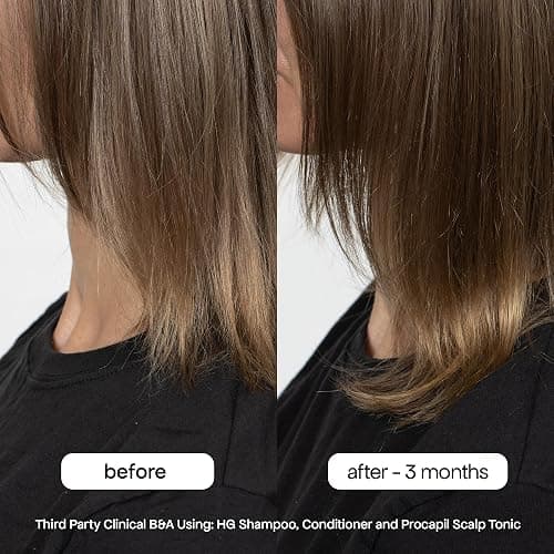 BondiBoost HG Anti-Thinning Shampoo Conditioner Set [16.90 fl oz each], Clinically Tested to Promote Fuller + Thicker-Looking Hair for Women & Men, Procapil, Redensyl & Rosemary Formula, Sulfate-Free thumbnail 6