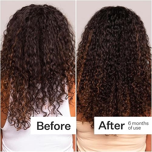 Act+Acre Cold Processed Stem Cell Scalp Serum - Promotes Thicker and Fuller-Looking Hair - Soothes and Hydrates the Scalp - Sulphate and Paraben Free - Aloe Vera for Improved Scalp Health - 1 fl oz. thumbnail 4