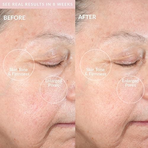 PMD Beauty Clean Pro OB - Smart Facial Cleansing Device thumbnail 4