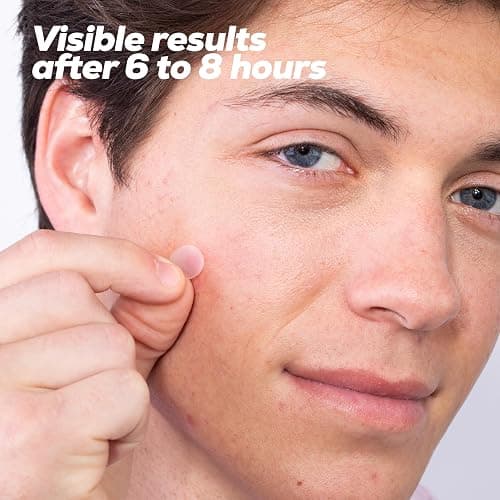 Hanhoo Extra Strength Blemish Patch Bundle, Salicylic Acid Pimple Patches, Shrinks Stubborn Pimples, Conceals Zits, Absorbs Fluid, Invisible Pimple Patches, Korean Skincare (Pack of 3, 108, Count) thumbnail 5