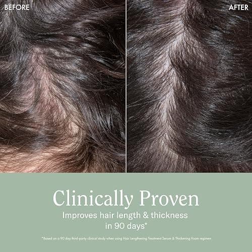 Rizos Curls Hair Lengthening Treatment Serum, Fortifies At Root for Healthy Scalp Microbiome Promoting Length, Supportes Longer Stronger Hair, 4.2 oz thumbnail 4