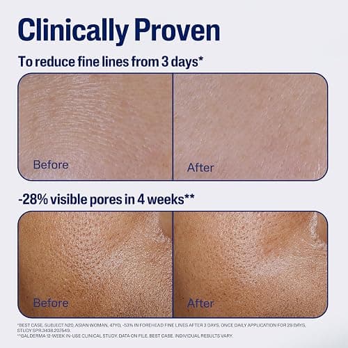CETAPHIL Advanced Defense Serum for Stressed Sensitive Skin with Gallic Acid & Vitamin E, AM Face Serum, Strengthens Skin Against Daily Stressors, Dermatologist Recommended, 1 fl oz Dropper Bottle thumbnail 4