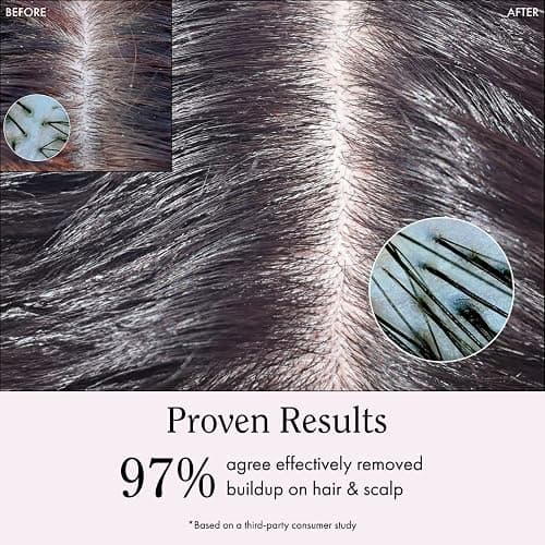 Rizos Curls Apple Cider Vinegar Scalp & Hair Rinse, Clarifies to Remove Product Buildup, Balance Oils, Revive Hair & Scalp, Enhances Softness & Shine, 10 oz thumbnail 4