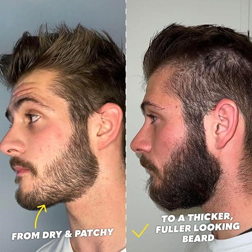 The Beard Club Signature Beard Growth Kit - Derma Roller, Beard Growth Oil, Beard Growth Vitamins, Vitamin Spray & Beard Brush - Gift Set thumbnail 6
