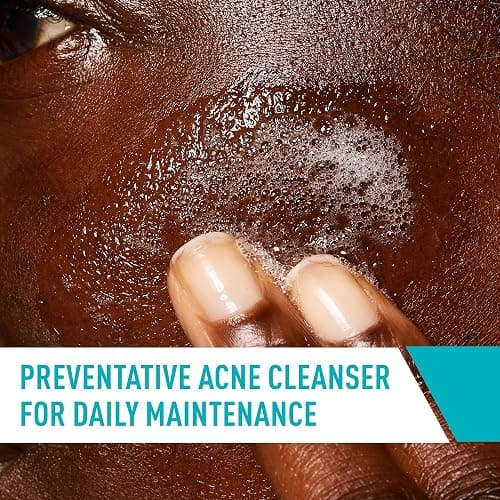CeraVe Acne Treatment Face Wash, Salicylic Acid Cleanser with Purifying Clay, Niacinamide, and Ceramides, Pore Control and Blackhead Remover, 8 Ounce thumbnail 4
