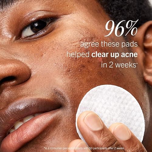 First Aid Beauty Acne Pads for Face - Maximum Strength Acne Treatment - 2% Salicylic Acid Pads Treat Without Drying, (60-ct) thumbnail 7