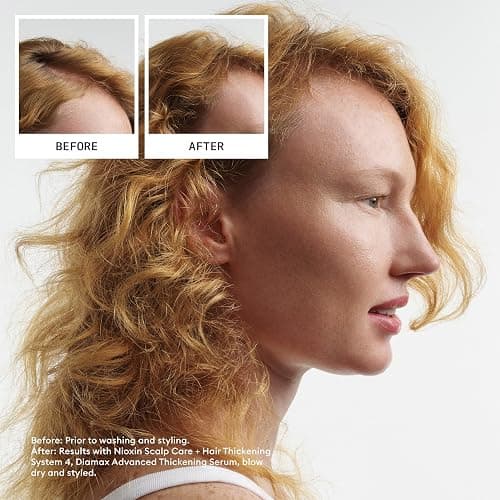 Nioxin Scalp + Hair Thickening System Kits | For Natural, Colored, & Damaged Hair with Light to Progressed Thinning | Strengthen & Boost Hair Density with Niacinamide & Biotin | 3 Month Supply thumbnail 2