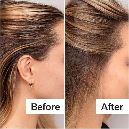 ACT+ ACRE Plant-Based Fulvic Acid Volumizing Dry Shampoo - Natural and Unscented Powder Spray Shampoo with Fulvic Acid and Rice Refresh Oily Hair and Restore Volume - Dry Shampoo for All Hair Types - 0.46 Ounce (Pack of 1) thumbnail 4