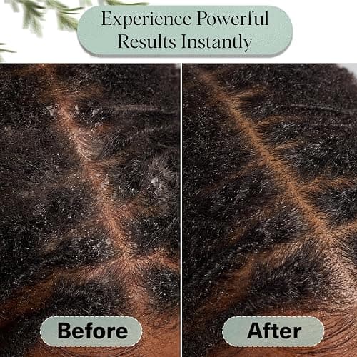 Kitsch Rosemary Oil for Hair Growth – Hair Oil with Biotin, Castor & Jojoba – Pre-Wash Scalp oil for Hair Care – Lavender Scent – 10mL | Ideal Gifts for Women thumbnail 7