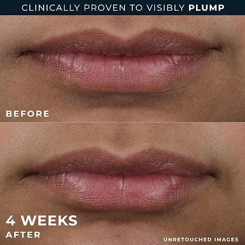 RoC Derm Correxion Lip Volumizer - Lip Plumper Peptide Treatment with Hyaluronic Acid & Vitamin E + Line Smoothing Eye Cream Packette thumbnail 6