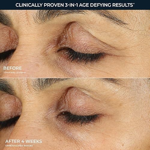 RoC Retinol Correxion Under Eye Cream for Dark Circles & Puffiness, 0.50z | Anti-Aging Retinol Eye Treatment, Clinically Proven, Daily Wrinkle Cream for Women & Men, Absorbs Fast, packaging may vary thumbnail 4
