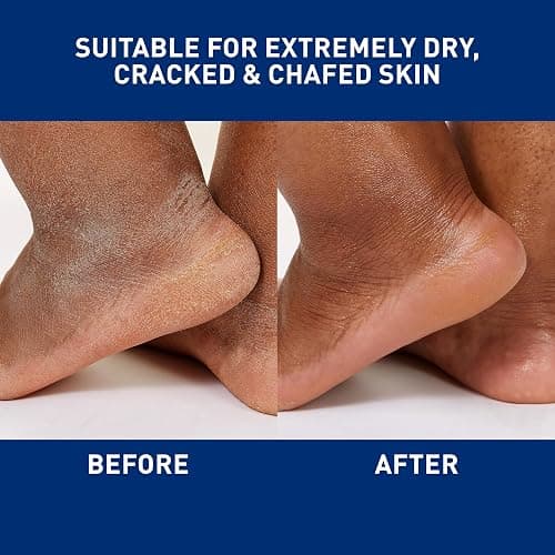 CeraVe Healing Ointment, Hydrating Skin Protectant With Petrolatum, Hyaluronic Acid & Ceramides, Face & Body Skin Barrier Repair For Cracked, Chafed, Dry Skin, Fragrance Free & Lanolin Free, 12 Oz thumbnail 4