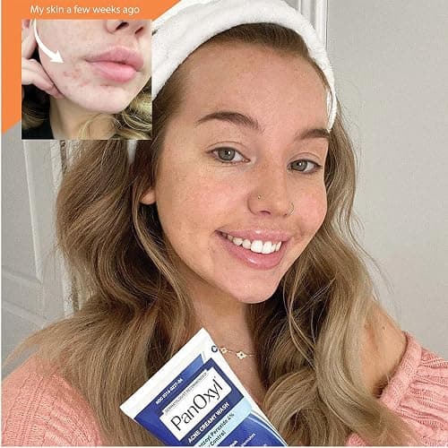 PanOxyl Creamy Acne Wash - 4% Benzoyl Peroxide thumbnail 4
