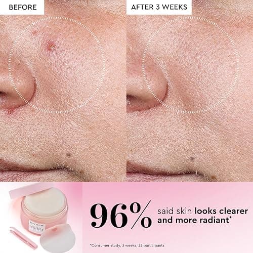 Glow Recipe LHA + AHA Toner Pads - Korean Exfoliating Toner for Face - Pore Minimizer - Hydrating Toner Pads - 5 Gentle Acids, Watermelon Enzymes, Hydrating Botanicals (60 Face Pads) thumbnail 4