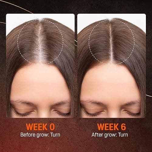 Abera Hair Growth Serum 1.69 fl oz for Hair Loss, Natural Hair Regrowth Treatment for Hair & Beard with Biotin & Castor Oil | Extra Strength & Bigger Size thumbnail 6