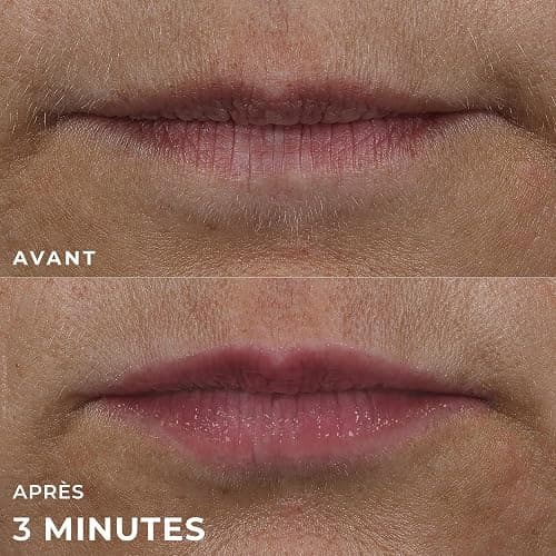 Serum repulpant levres thumbnail 8