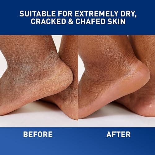 CeraVe Healing Ointment, Hydrating Skin Protectant With Petrolatum, Hyaluronic Acid & Ceramides, Face & Body Skin Barrier Repair For Cracked, Chafed, Dry Skin, Fragrance Free & Lanolin Free, 5 Oz thumbnail 5