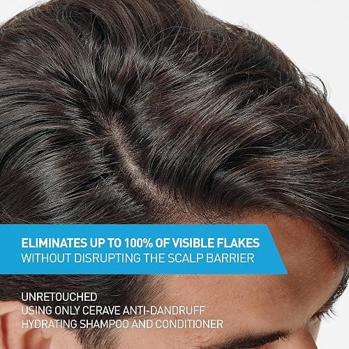 CeraVe Hydrating Anti Dandruff Shampoo, 1% Pyrithione Zinc Dandruff Treatment With Ceramides, Niacinamide & Hyaluronic Acid, Helps Eliminate Flakes & Provides Itchy Scalp Relief, Sulfate Free, 12 Oz thumbnail 3