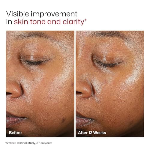 EltaMD UV Clear Tinted Sunscreen for Face, SPF 46 with Zinc Oxide, Oil-Free, Dermatologist Recommended, For Acne-Prone Sensitive Skin, 1.7 oz thumbnail 8