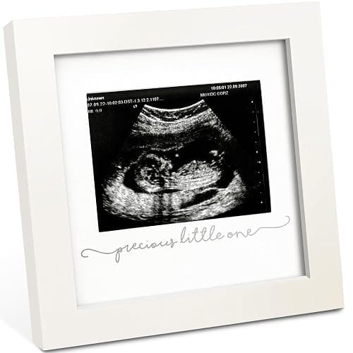 KeaBabies Baby Sonogram Picture Frame - Modern Ultrasound Picture Frames for Mom to Be, First Pregnancy Gifts for Expecting Mom & First Time Dad, Baby Gender Reveal Gifts (Alpine White) - Image 1